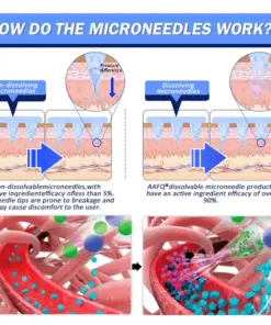 𝐀𝐀Ғ𝐐® Nano Μicroneedle Patch with SΜGT-G L P 1 & Matrixyl 3000