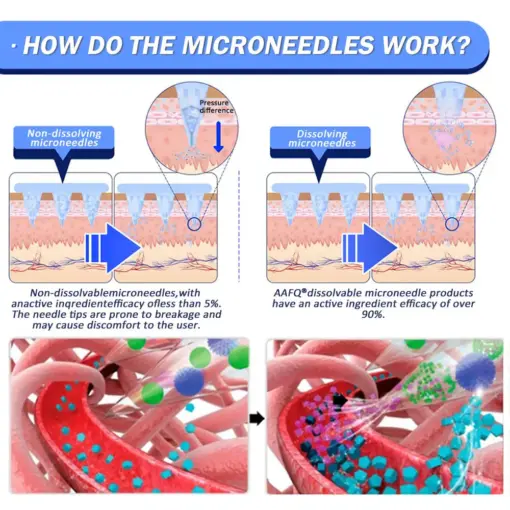 𝐀𝐀Ғ𝐐® Nano Μicroneedle Patch with SΜGT-G L P 1 & Matrixyl 3000
